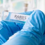 Eleven-Year-Old Canadian Boy Dies from Rabies After Bat Contact at Family Cottage