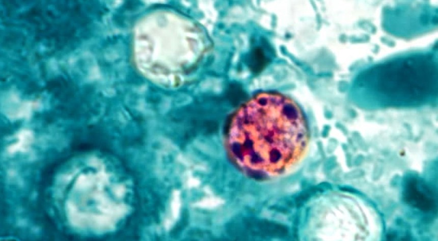 Two Michigan Residents Die Following Cyclosporiasis Infections Amid Nationwide Outbreak