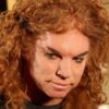Prop Comedy Icon Carrot Top Receiving Medical Care in Hospital